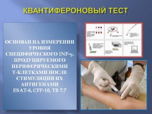 Квантифероновый тест - новое слово в медицине.