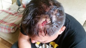 Вертухаи устроили кровавую драку в агроусадьбе "Калинова Долина" в деревне Семёново близ Мушковичей