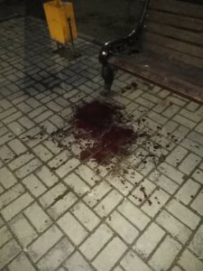 Мужчина среди бела дня пытался покончить с собой