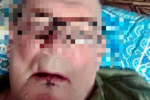Упал так, что зубы вдребезги!