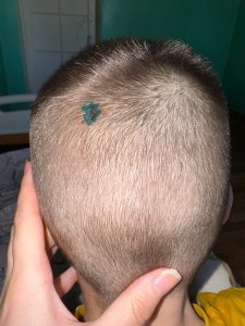Пострадал ребенок